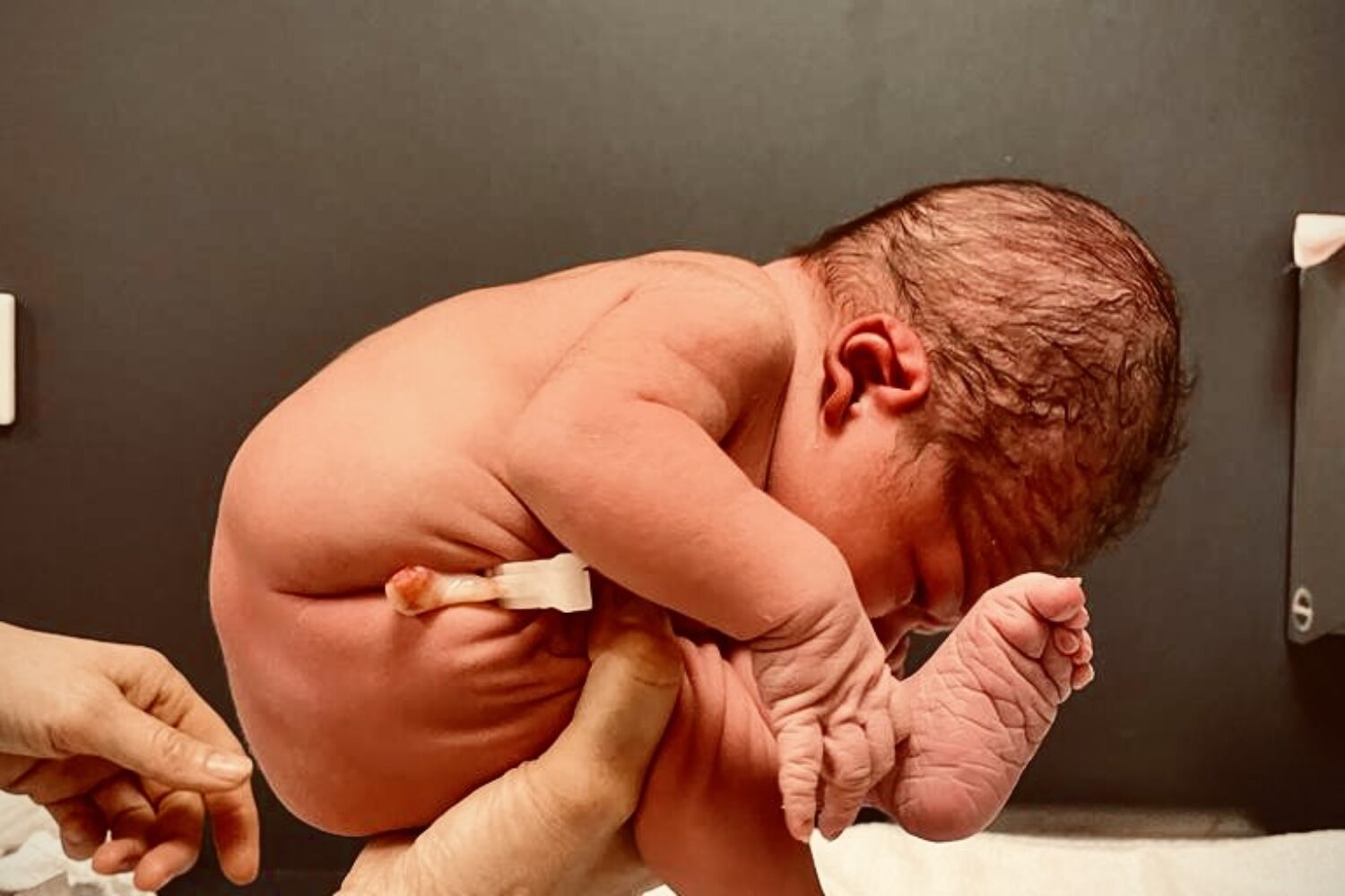 neonato in posizione fetale