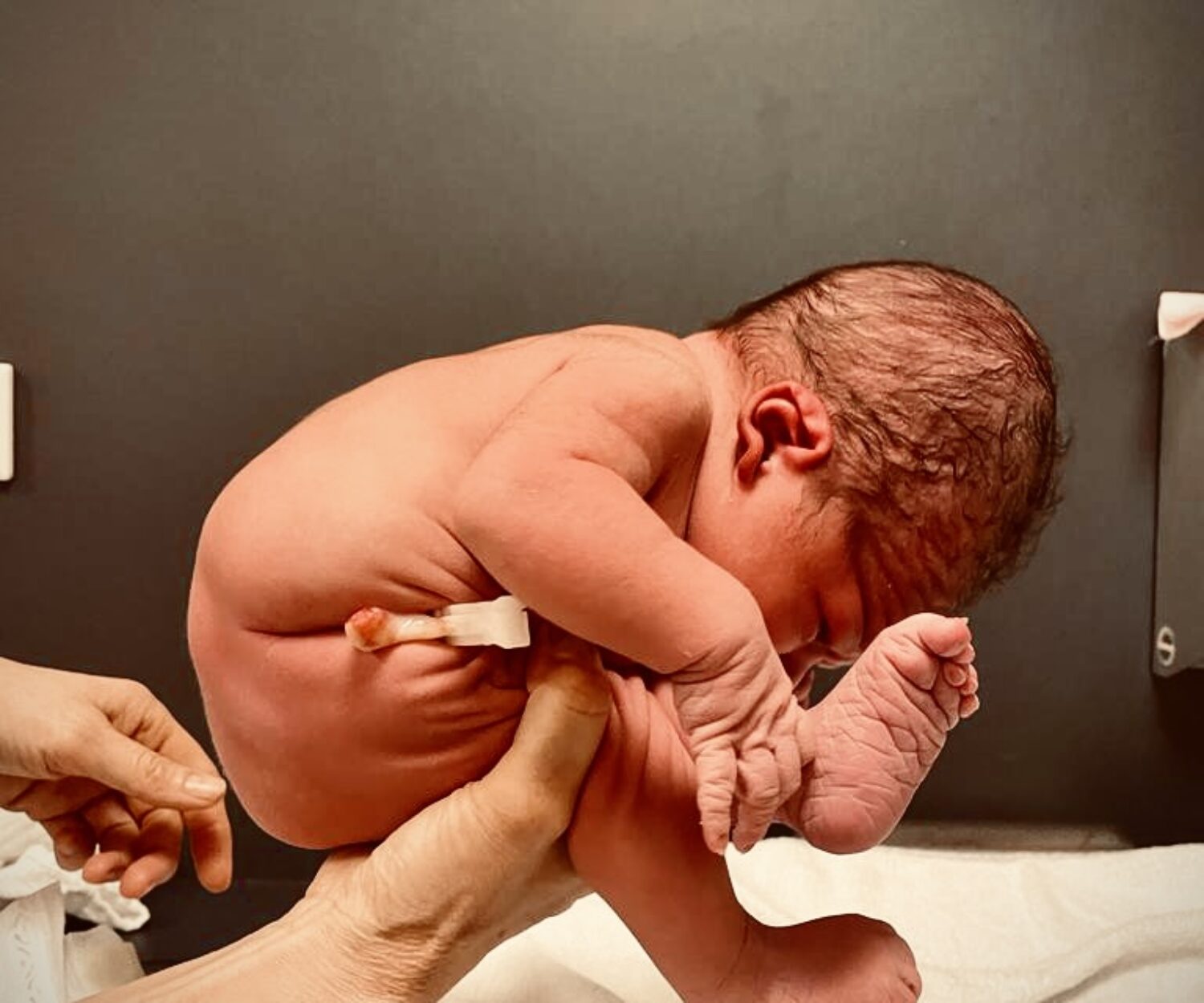 neonato in posizione fetale